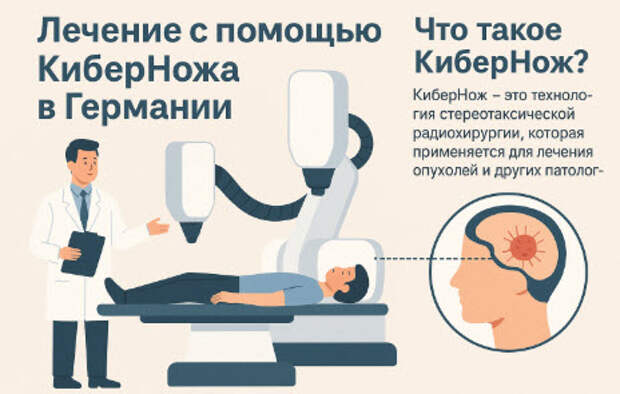 КиберНож 3 КиберНож в Германии