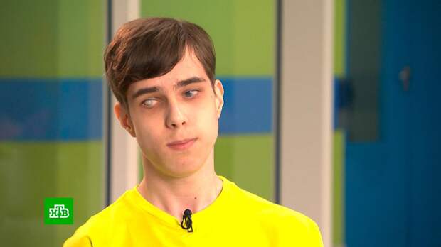 Семнадцатилетнему слепому Георгию нужны деньги на операцию на позвоночнике