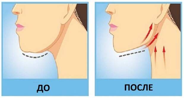 Reduce-Double-Chin-Fast-At-Home