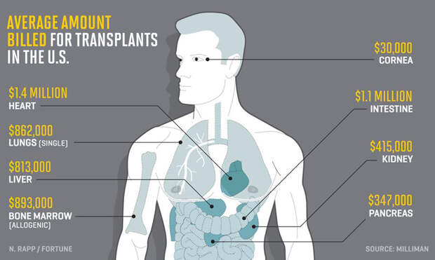 Human-Transplantants