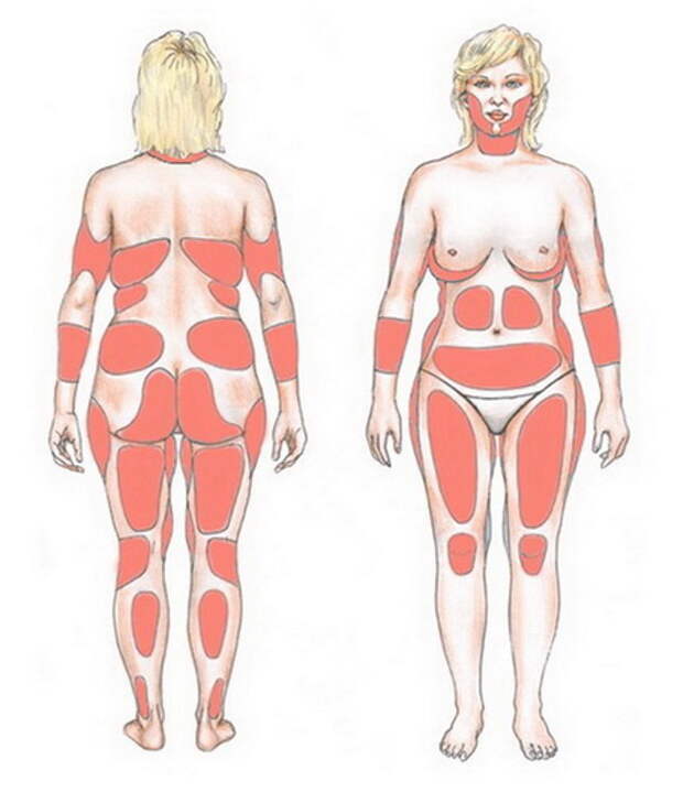 koroleva