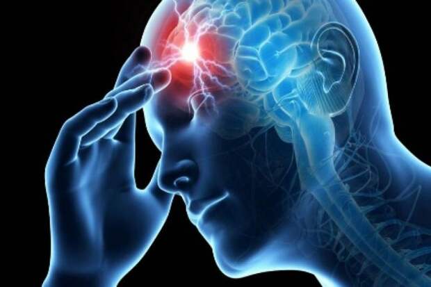 AHA: Ученые обнаружили неожиданный фактор, влияющий на смертность после инсульта