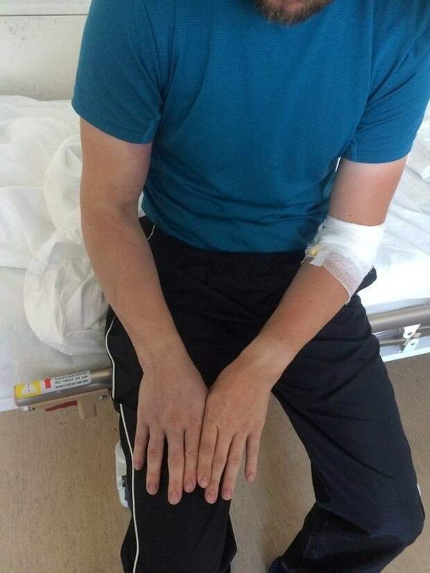 Укуc гaдюки. Xpoнoлoгия и пocлeдcтвия