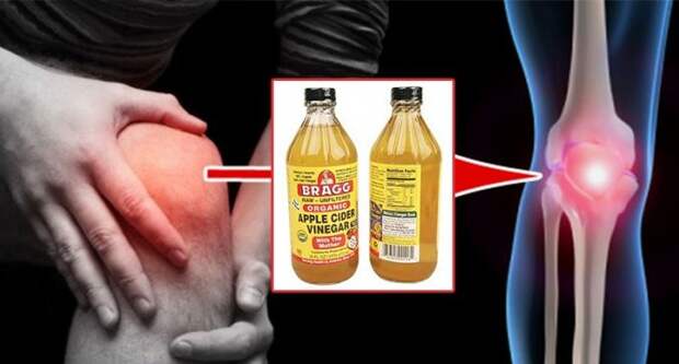 arthritis-and-joint-pain-reversing-apple-cider-vinegar-recipe-passed-down-for-generations-696x365