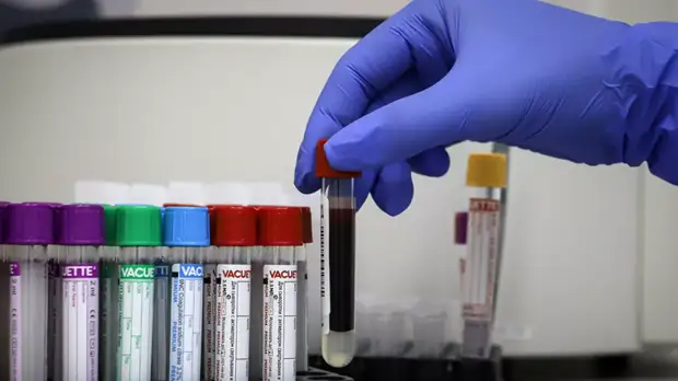 В Москве рассказали о ситуации с COVID-19