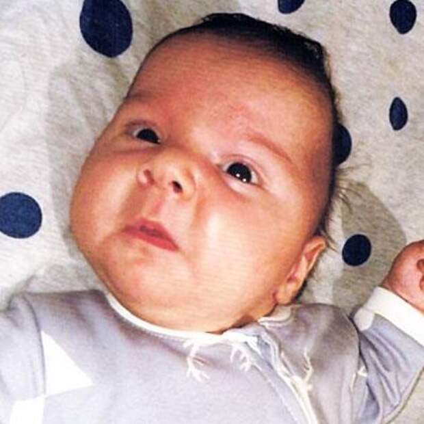 Мухаммад-Али Дзауров, 3 месяца, деформация черепа, требуется лечение специальными шлемами-ортезами, 176 119 ₽