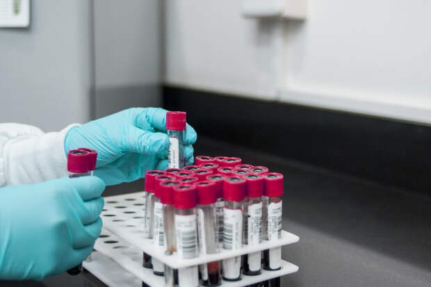 Анализ на ВПЧ для россиянок стал бесплатным