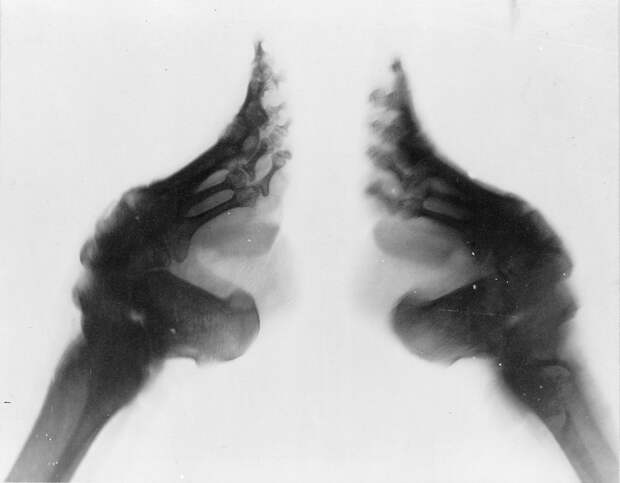 Рентгеновский снимок искалеченной ноги / ©Библиотека Конгресса США