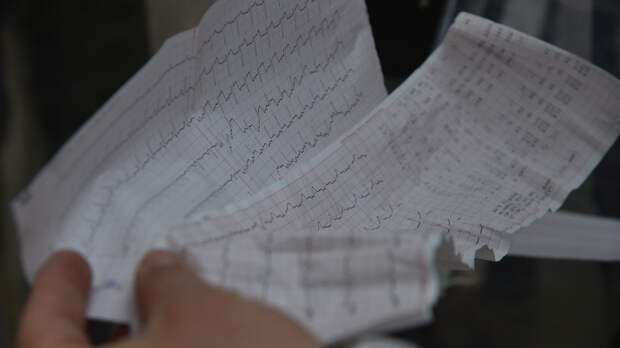 На Камчатке врачи спасли жизнь мужчине, отбивая ритм его сердца по телефону