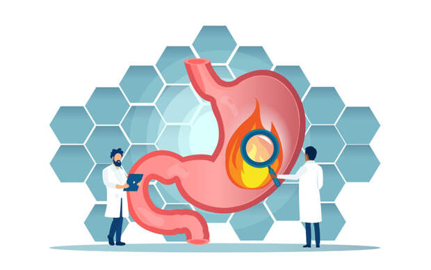 Почему случается изжога?