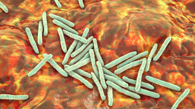 Болезнь-невидимка. Как опасная инфекция маскируется под цистит, простуду и боли в спине. Реальная история из практики