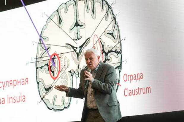 Российские ученые нашли новый способ выявлять шизофрению по работе мозга