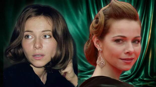 От природной красоты до кардинальных перемен: как звёзды сохраняют молодость и меняют себя