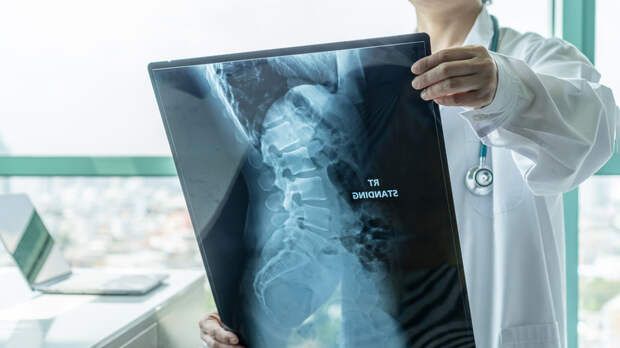 В России представили первый в мире препарат для лечения болезни Бехтерева