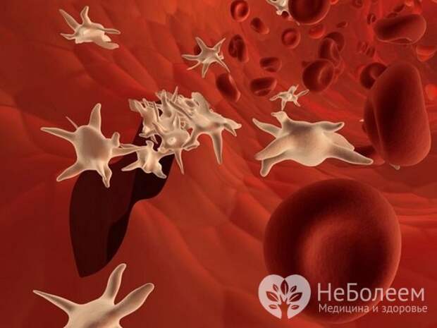 Пониженное количество тромбоцитов в крови у ребенка становится причиной кровоточивости