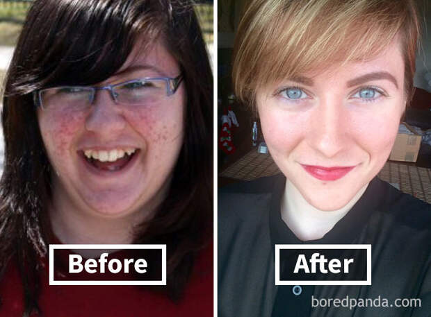 Фотография: 32 вдохновляющих примера того, как похудение преображает лицо №33 - BigPicture.ru