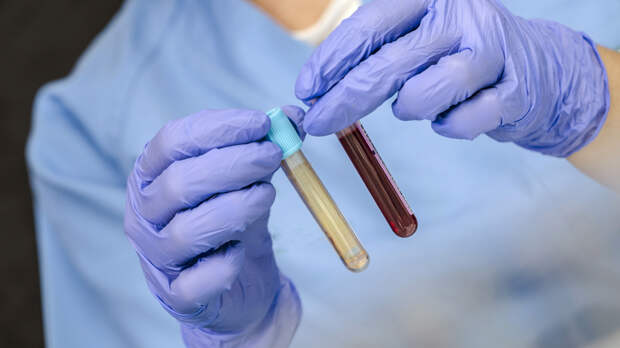 Популярные, но бесполезные анализы: на что не стоит тратить деньги