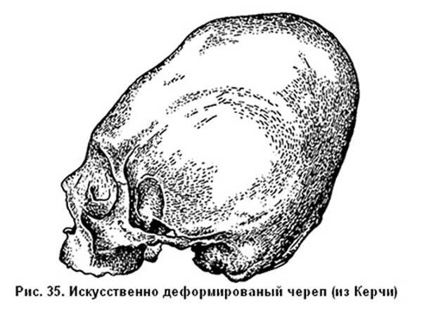 Вытянутые черепа