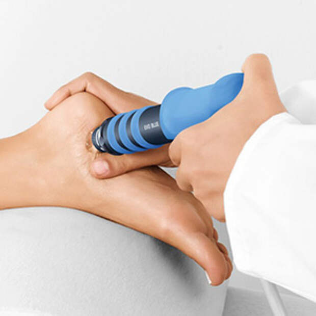 Пяточная шпора (плантарный фасциит): УВТ как золотой стандарт лечения