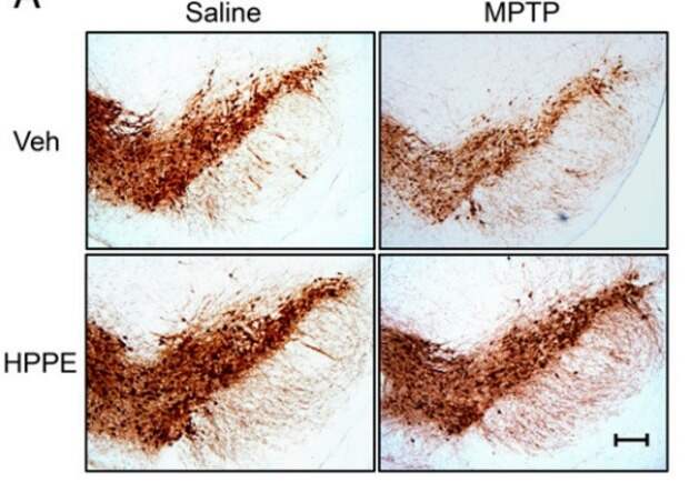 Ингибитор фактора транскрипции защитил мышей от болезни Паркинсона