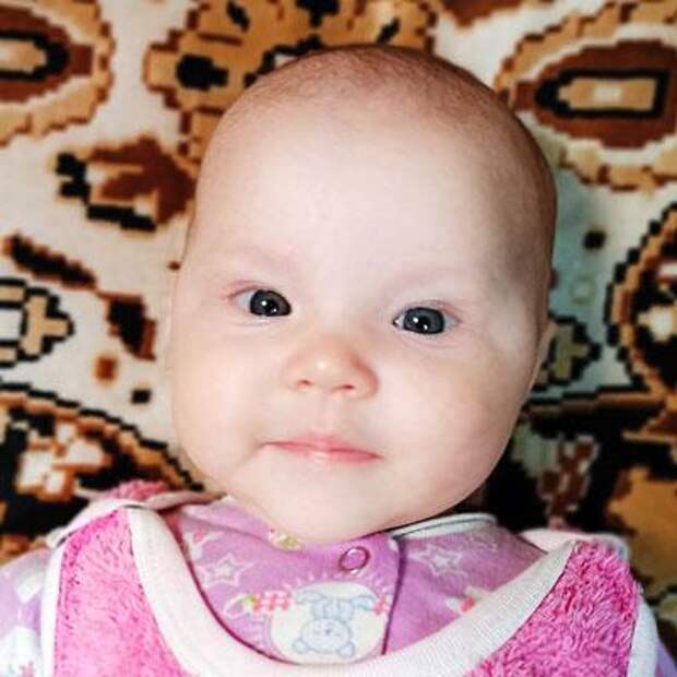 Вероника Ибрагимова, 4 месяца, врожденная двусторонняя косолапость, требуется лечение по методу Понсети, 86 401 ₽
