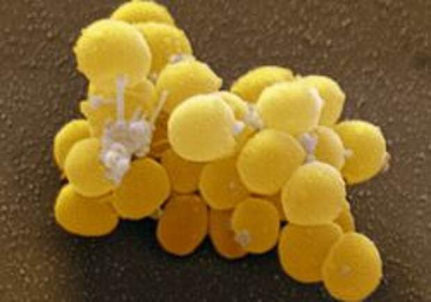 Бактерии staphylococcus aureus. Стафилококк гроздья винограда. Стафилококк золотистый Staphylococcus aureus. Стафилококк ауреус гроздья Виноградов. Золотистый стафилококк под микроскопом.