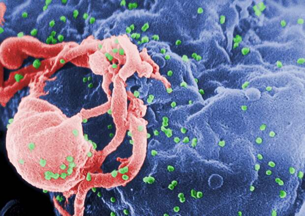 Антибиотик помог иммунной системе распознать клетки с ВИЧ