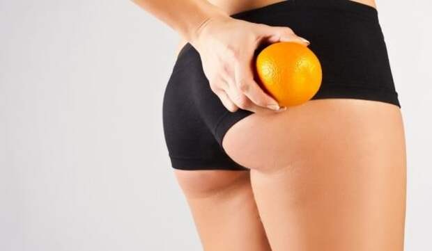Cellulite