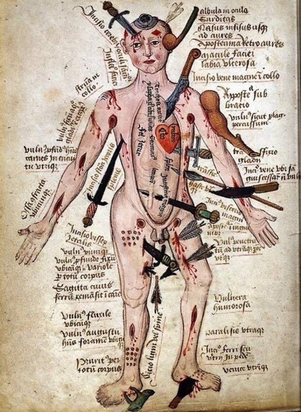 2. Военно-полевая хирургия. медицина, средние века