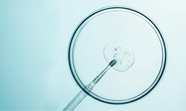 «Мне собираются удалять матку — можно ли одновременно с этим заморозить яйцеклетки?»