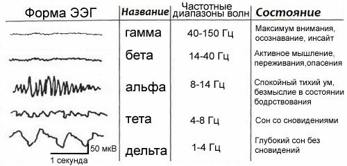 Управление с помощью нейронов головного мозга (с помощью мысли)