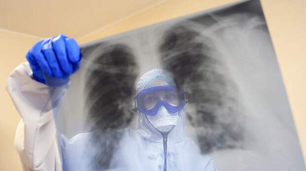 Врач рассказал о выявлении бессимптомной пневмонии