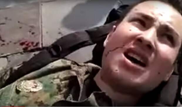 В Киеве подрезали боевика ОУН - «герой» получил по «заслугам»
