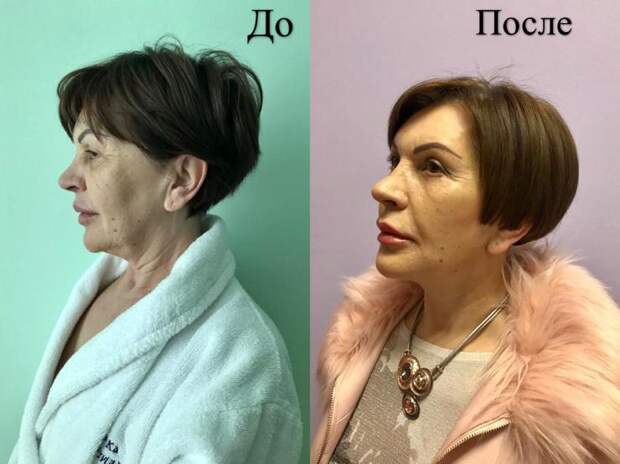 До и после До и после