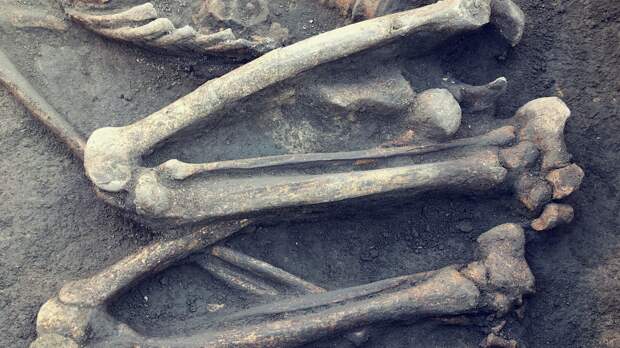 В древних скелетных останках выявили редкое генетическое заболевание