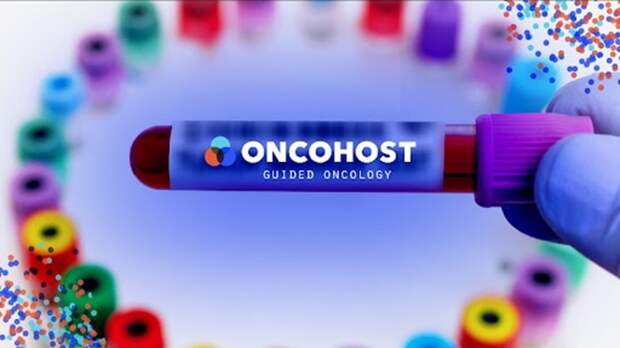 OncoHost запускает исследование биомаркеров почечно-клеточного рака – Mobile Health Times