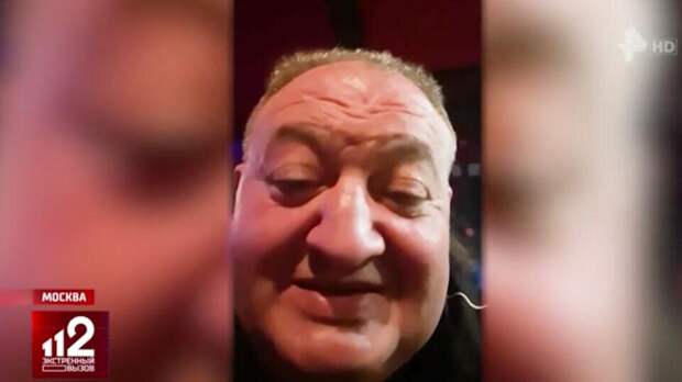 Вот так выглядел азербайджанец Надир Абулов, брачный аферист, жертвами которого стали 10 женщин. И вот таким лицом, похожим на картофель, он и очаровывал женщин