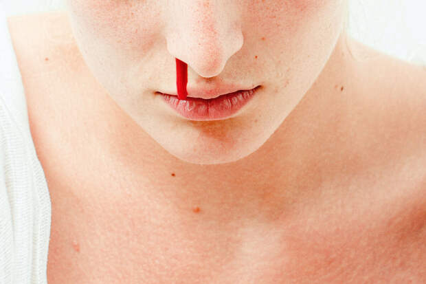 Врач Эдигер: ковыряние в носу повреждает костный аппарат и разрушает слизистую