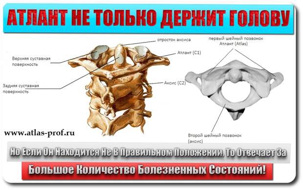 смещение атланта первого шейного позвонка подвывих атланта первого шейного позвонка