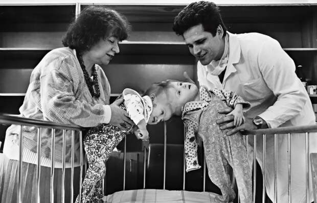 Как сложилась судьба сиамских близнецов Вилии и Виталии, разделённых 35 лет назад