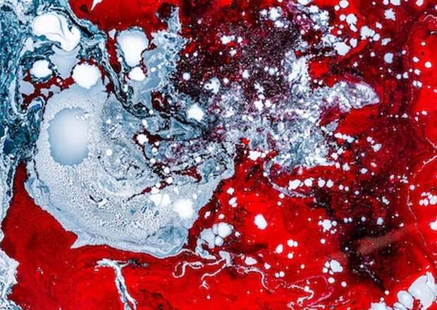 Чистить кровеносные сосуды опасно для здоровья: терапевт Ескова