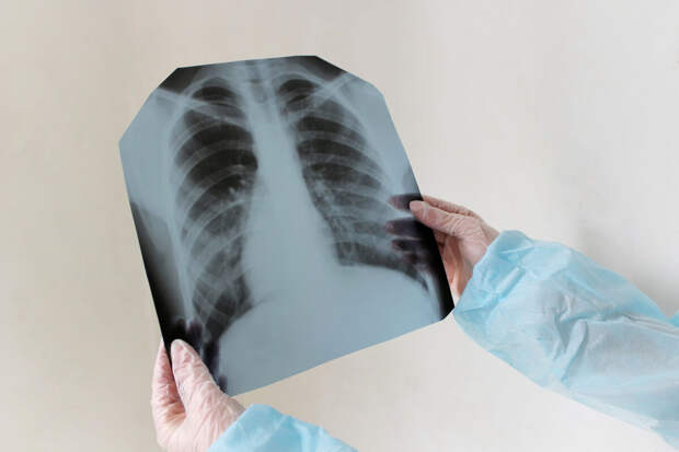 Amur Mash: туберкулез нашли у студента ВБМК, учащихся перевели на дистант