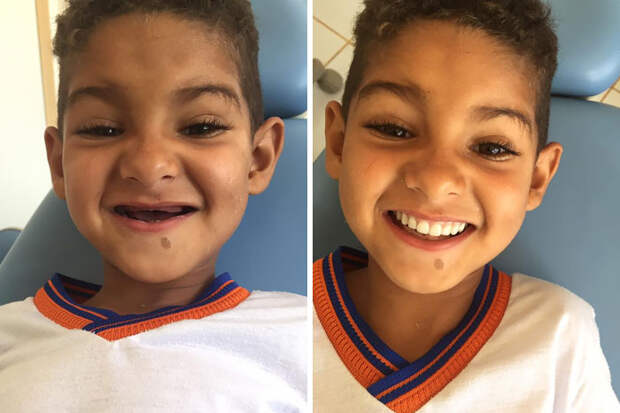 Dentist Makes A Boy's Dream Come True When He Gives Him A Smile 