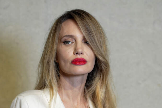 Хирург Хайдар заявила, что Анджелине Джоли сделали неудачную блефаропластику