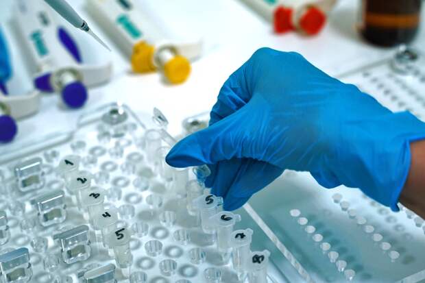 Риск синдрома Дауна у плода будут определять по крови мамы