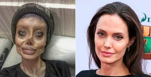 Девушка с пластическими операциями чтобы выглядеть как Джоли