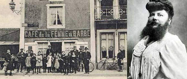 История бородатой француженки