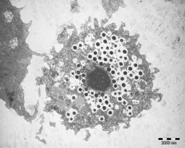 Клетка амебы, заполненная частицами гигантского вируса