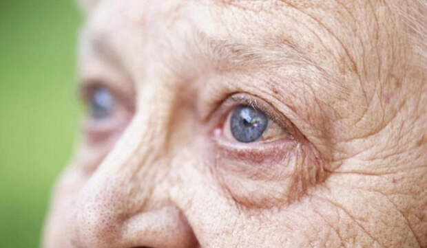 Катаракта у пожилых: как не пропустить симптомы и распознать начальную стадию заболевания