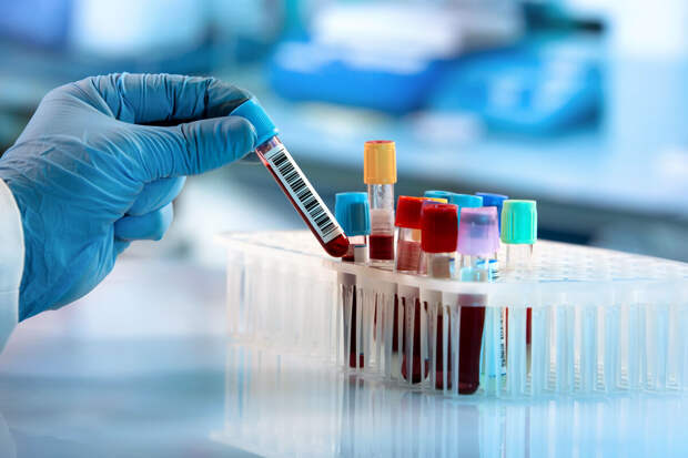 Nature: особые белки в крови предупреждают о раке за семь лет до его диагностики